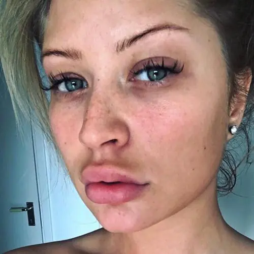 hotteveyy image 0